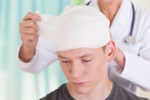 Delayed Symptoms to Watch for After a Head Injury