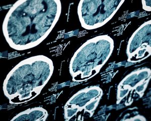 Traumatic Brain Injury Resources in Tennessee