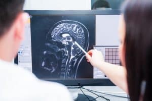 Younger Generation More at Risk for a Traumatic Brain Injury if They Have ADHD