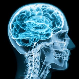 Understanding the Severity of Your Traumatic Brain Injury